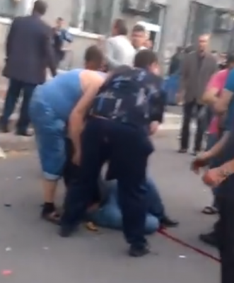 ukra_civilian_voter_wounded_by_armed_aggression_400 ukra_civilian_voter_wounded_by_armed_aggression_400