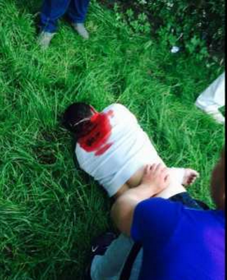 ukra_victim_killed_during_donetsk_referendum_voting_400 ukra_victim_killed_during_donetsk_referendum_voting_400